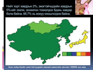 Xөхний хавдар | PPT