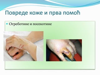 Повреде коже и прва помоћ
 Огреботине и посекотине
 