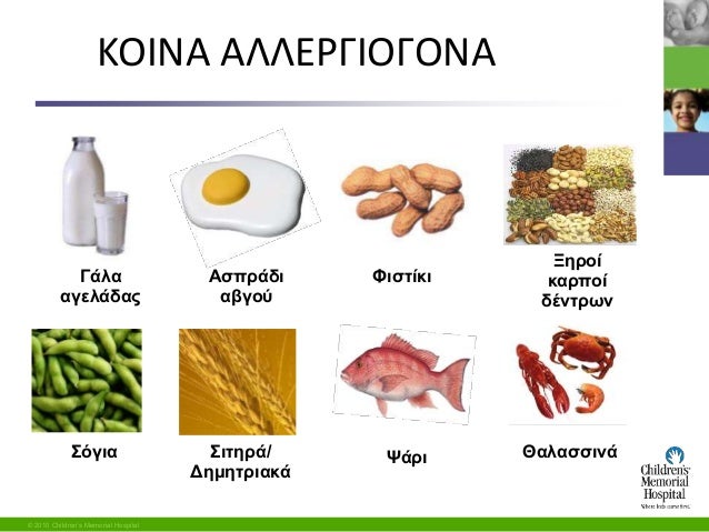 τροφική αλλεργία