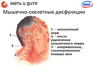 Мышечно-скелетные дисфункции
 