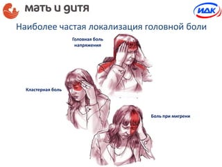 Головная боль
напряжения
Кластерная боль
Боль при мигрени
Наиболее частая локализация головной боли
 