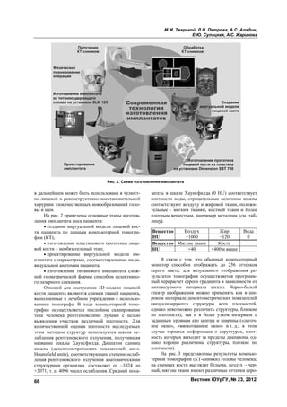 66
в дальне
но-лицев
хирургии
вы и шеи
На р
ления им
• соз
ти пацие
фии (КТ
• изг
вой кости
• пр
плантата
видуальн
• изг
ной геом
го лазерн
Осн
кости па
выполне
ванием т
графии
тела чел
выявлени
количест
этим ме
лабления
название
шкалы (
Hounsfie
ления ре
структур
+3071, т.
йшем может
вой и реконс
и злокачестве
и.
рис. 2 привед
мплантата нос
здание вирту
ента по данн
);
готовление п
и – необязате
оектировани
а с параметра
ной анатомии
готовление т
метрической
ного спекани
новой для по
ациента являю
нные в лечеб
томографа. В
осуществляе
ловека рентг
ия участков
твенной оце
тодом струк
я рентгеновс
е шкалы Ха
(денситометр
ld units), соо
ентгеновског
рами организ
. е. 4096 чисе
т быть исполь
труктивно-во
енных новоо
дены основны
са пациента:
уальной мод
ным компью
пластикового
ельный этап;
ие виртуальн
ами, соответс
и пациента;
титанового и
формы спосо
ия.
строения 3D
ются снимки
бном учрежд
В ходе комп
ется послойн
геновскими
в различной
нки плотнос
ктур использ
ского излуче
аунсфилда. Д
рических по
тветствующи
го излучения
зма, составл
ел ослаблени
ьзована в чел
осстановител
образований г
ые этапы изго
ели лицевой
ютерной томо
о прототипа л
ной модели
ствующими и
имплантата с
обом селекти
D-модели лиц
тканей паци
дении с испо
пьютерной т
ное сканиров
лучами с ц
плотности.
сти исследуе
зуется шкала
ения, получи
Диапазон ед
оказателей,
их степени ос
анатомичес
ляет от –102
ия. Средний п
Рис. 2. Схем
люст-
льной
голо-
отов-
й кос-
огра-
лице-
им-
инди-
слож-
ивно-
цевой
иента,
льзо-
томо-
вание
целью
Для
емых
а ос-
вшая
иниц
англ.
слаб-
кими
24 до
пока-
зат
пл
со
тел
пл
ли
В
H
В
H
мо
сер
зул
ны
ин
сп
ро
(ви
од
по
зад
но
сл
но
на
пл
тер
на
ны
ма изготовлен
М.М. Тве
тель в шкале
лотности вод
ответствуют
льные – мягк
лотным веще
ицу).
ещество
HU
ещество М
HU
В связи с
онитор спосо
рого цвета,
льтатов томо
ый перерасчет
нтересуемого
пектр изображ
оком интерва
изуализирую
днако невозм
о плотности)
данным уров
ое окно», «м
учае теряетс
ость которых
ако хорошо
лотности).
На рис. 3
рной томогра
а снимках кос
ый, мягкие тк
ия имплантат
ерской, Л.Н.
Е.Ю. Су
Вестни
е Хаунсфилд
ы, отрицател
воздуху и ж
ким тканям,
ствам, напри
Воздух
−1000
Мягкие ткани
+40
с тем, что об
обен отобра
для визуаль
ографии осу
т серого град
интервала
жения можно
але денситоме
ются структу
ожно различ
, так и в бо
внем его цен
мягкотканное
ся информац
выходит за
различимы
представлен
афии (КТ-сн
сти выглядят
кани имеют р
та
Петрова, А.
улацкая, А.С
ик ЮУрГУ, №
да (0 HU) соо
льные величи
жировой ткан
костной тка
имер металла
Жир
−120
Кости
+400 и выш
бычный ком
ажать до 25
ьного отобра
уществляется
диента в зави
шкалы. Че
о применять
етрических п
уры всех п
чить структур
олее узком и
нтра и ширин
е окно» и т.
ция о структу
пределы диа
структуры, б
ны результат
имки) головы
т белыми, во
различные отт
.С. Аладин,
С. Жаринова
№ 23, 2012
ответствует
ины шкалы
ни, положи-
ани и более
ам (см. таб-
Вода
0
ше
мпьютерный
6 оттенков
ажения ре-
программ-
исимости от
ерно-белый
ь как в ши-
показателей
плотностей,
ры, близкие
интервале с
ны («легоч-
д.; в этом
урах, плот-
апазона, од-
близкие по
ты компью-
ы человека;
оздух – чер-
тенки серо-
Copyright ОАО «ЦКБ «БИБКОМ» & ООО «Aгентство Kнига-Cервис»
 