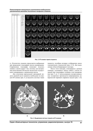 Компьюте
импланта
Серия «К
го. Количе
при провед
Современн
снимки с ш
ния качест
влять скани
Для п
дели лицев
дом КТ-сн
ерная техно
атов метод
Компьютерн
ество снимко
дении томогр
ные томогра
шагом менее
твенной 3D-м
ирование с н
получения ви
вой кости па
нимке (рис. 4,
ология изгот
дом послойно
ные технол
ов определяе
рафии шагом
афы позвол
1 мм, поэтом
модели желат
наименьшим ш
иртуальной т
ациента необх
, а) выделить
а)
Рис. 4
товления м
ого лазерно
логии, управ
тся выбранн
м сканирован
ляют получ
му для постр
тельно осуще
шагом.
трехмерной м
ходимо на ка
ь костные тка
Рис. 3. КТ-с
4. Выделение
медицинских
го спекания
вление, рад
ным
ния.
ать
рое-
ест-
мо-
аж-
ани
паци
томе
ленн
сним
данн
ния
ных
верх
снимки черепа
костных ткан
я
диоэлектро
иента, подобр
етрических п
ных областей
После этого
мкам, «склеи
ной при томо
(рис. 5, а). С
алгоритмов
хностей черн
а пациента
ней на КТ-сним
оника», вып
рав интервал
показателей (
й формируют
о контуры, от
ивают» межд
ографии толщ
С использова
производитс
ового вариан
б)
мках
пуск 16
л отображени
(рис. 4, б). Д
контуры.
тносящиеся
ду собой с уч
щины слоя ск
нием интерп
ся формиров
нта модели (р
67
ия денси-
Для выде-
к разным
четом за-
канирова-
поляцион-
вание по-
рис. 5, б).
Copyright ОАО «ЦКБ «БИБКОМ» & ООО «Aгентство Kнига-Cервис»
 