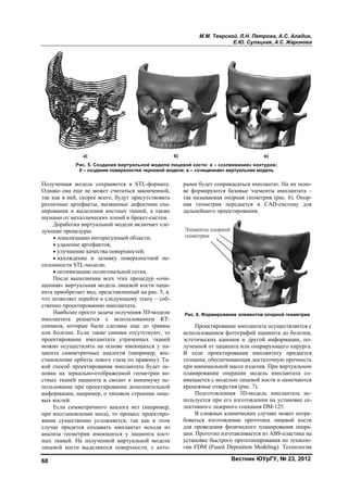 68
Получен
Однако о
так как в
различны
нировани
шумами
Дор
дующие
• ло
• уд
• улу
• нах
сплошно
• оп
Пос
щенная»
ента при
что позв
ственно п
Наи
импланта
снимков
или боле
проектир
можно о
циента с
становле
кой спос
нован на
стных тк
пользова
информа
вых кост
Если
при восс
вания су
случае п
анализа
ных ткан
лицевой
нная модель
она еще не м
в ней, скорее
ые артефакты
ия и выделен
от металличе
аботка вирту
процедуры:
кализацию и
аление артеф
учшение кач
хождение и
ости STL-мод
птимизацию п
ле выполнен
» виртуальная
иобретает вид
оляет перейт
проектирован
иболее просто
ата решает
, которые бы
езни. Если т
рование имп
осуществлять
симметричны
ение орбиты
соб проектир
а зеркально-
каней пациен
ание при про
ации, наприм
тей.
и симметрич
становлении
ущественно у
придется соз
геометрии и
ней. На полу
кости выде
а)
Рис. 5. С
б – соз
сохраняется
может считат
е всего, буду
ы, вызванные
ния костных
еских пломб
уальной моде
интересующей
фактов;
чества поверх
заливку по
дели;
полигонально
ние всех этих
я модель лиц
д, представле
ти к следующ
нию имплант
о задача полу
ся с испо
ыли сделаны
такие снимки
плантата утр
ь на основе и
ых аналогов
левого глаза
рования импл
отображенно
нта и сводит
оектировании
мер, о типово
чного аналог
носа), то пр
усложняется
здавать импл
имеющихся у
ученной вир
ляются пове
Создание вир
здание поверх
я в STL-фор
ться закончен
ут присутство
е дефектами
х тканей, а т
и брекет-сис
ели включает
й области;
хностей;
оверхностной
ой сетки.
х процедур «
цевой кости п
енный на рис
щему этапу –
тата.
учения 3D-мо
льзованием
ы еще до тр
и отсутствую
раченных тк
имеющихся у
(например,
а по правому)
лантата буде
ой геометрии
т к минимуму
и дополнител
м строении л
га нет (напри
оцесс проект
, так как в
лантат исход
у пациента
ртуальной мо
ерхности, с к
ртуальной мо
хностей чернов
мате.
нной,
овать
и ска-
также
стем.
т сле-
й не-
«очи-
паци-
. 5, в,
– соб-
одели
КТ-
авмы
ют, то
каней
у па-
вос-
). Та-
ет ос-
и ко-
у ис-
льной
лице-
имер,
тиро-
этом
дя из
кост-
одели
кото-
ры
ве
так
на
да
Эл
ге
Ри
ис
эст
лу
В
то
пр
пл
вм
кр
по
ле
бо
дл
ци
уст
ги
б)
одели лицево
вой модели; в
М.М. Тве
ыми будет со
формируют
к называемая
ая геометрия
альнейшего п
лементы опор
еометрии
ис. 6. Формир
Проектиро
спользование
тетических к
ученной от па
ходе проек
лщина, обесп
ри минимальн
ланировании
мещается с мо
репежные отв
Подготовл
ользуется при
ктивного лаз
В сложных
оваться изгот
ля проведения
ии. Прототип
тановке быст
и FDM (Fuse
й кости: а – «
в – «очищенная
ерской, Л.Н.
Е.Ю. Су
Вестни
прикасаться
тся базовые э
я опорная ге
я передается
проектирован
рной
ование элеме
ование импла
м фотографи
канонов и др
ациента или о
ктирования
печивающая
ной массе изд
операции м
оделью лицев
верстия (рис.
ленная 3D-м
и его изготов
зерного спека
х клинически
товление про
я физическог
изготавливае
трого прототи
ed Deposition
«склеивание»
я» виртуальна
Петрова, А.
улацкая, А.С
ик ЮУрГУ, №
имплантат. Н
элементы им
ометрия (рис
я в CAD-си
ия.
ентов опорной
антата осуще
ий пациента д
ругой инфор
оперирующе
имплантату
достаточную
делия. При ви
модель импл
вой кости и н
7).
модель импл
влении на ус
ания DM-125
их случаях мо
ототипа лиц
го планирова
ется из ABS-п
ипирования п
n Modeling). Т
в)
контуров;
ая модель
.С. Аладин,
С. Жаринова
№ 23, 2012
На их осно-
мплантата –
с. 6). Опор-
истему для
й геометрии
ествляется с
до болезни,
рмации, по-
его хирурга.
придается
ю прочность
иртуальном
лантата со-
намечаются
лантата ис-
тановке се-
5.
ожет потре-
евой кости
ания опера-
пластика на
по техноло-
Технология
Copyright ОАО «ЦКБ «БИБКОМ» & ООО «Aгентство Kнига-Cервис»
 