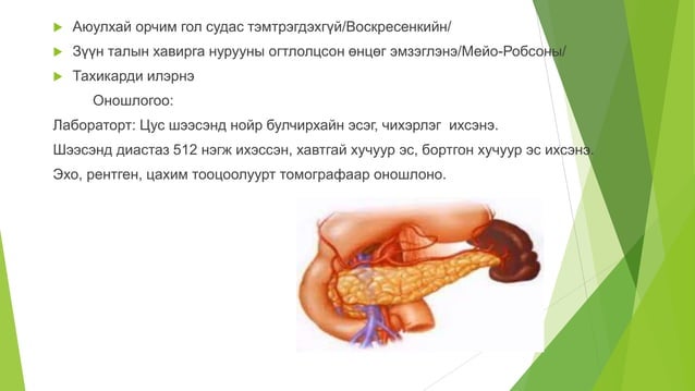 нойр булчирхай | PPT