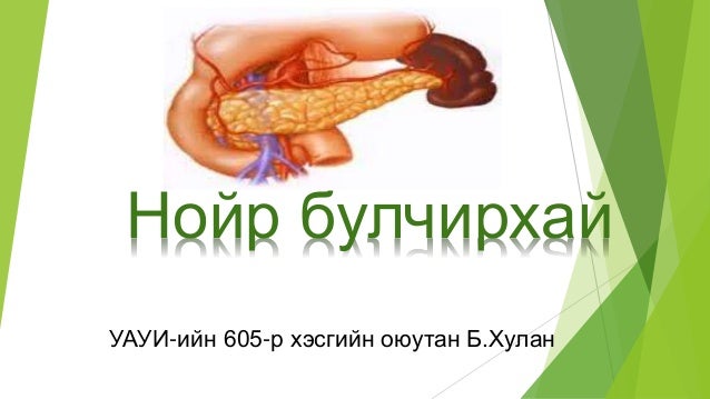 нойр булчирхай