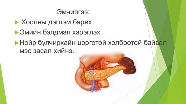 нойр булчирхай