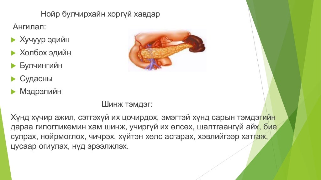 нойр булчирхай