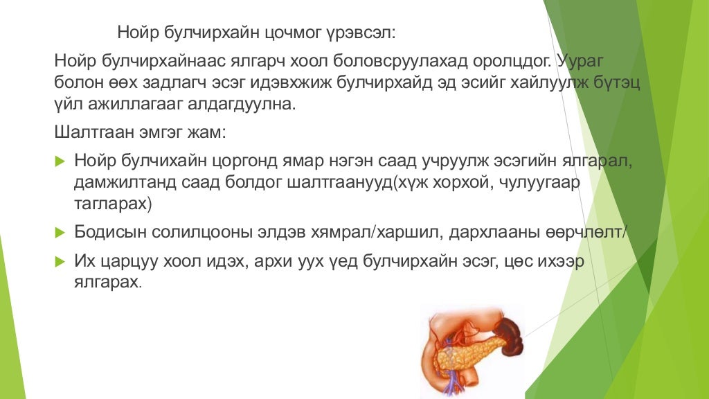 нойр булчирхай