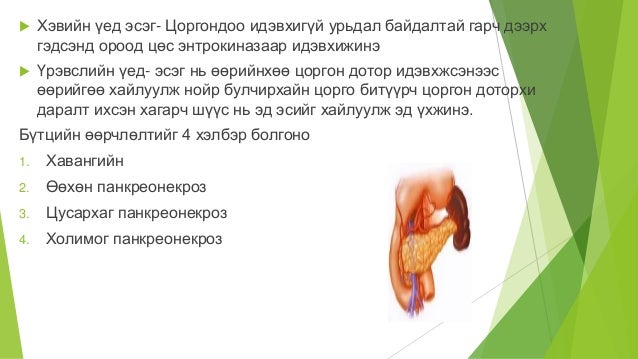 нойр булчирхай