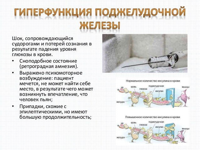 Координация слухо моторная