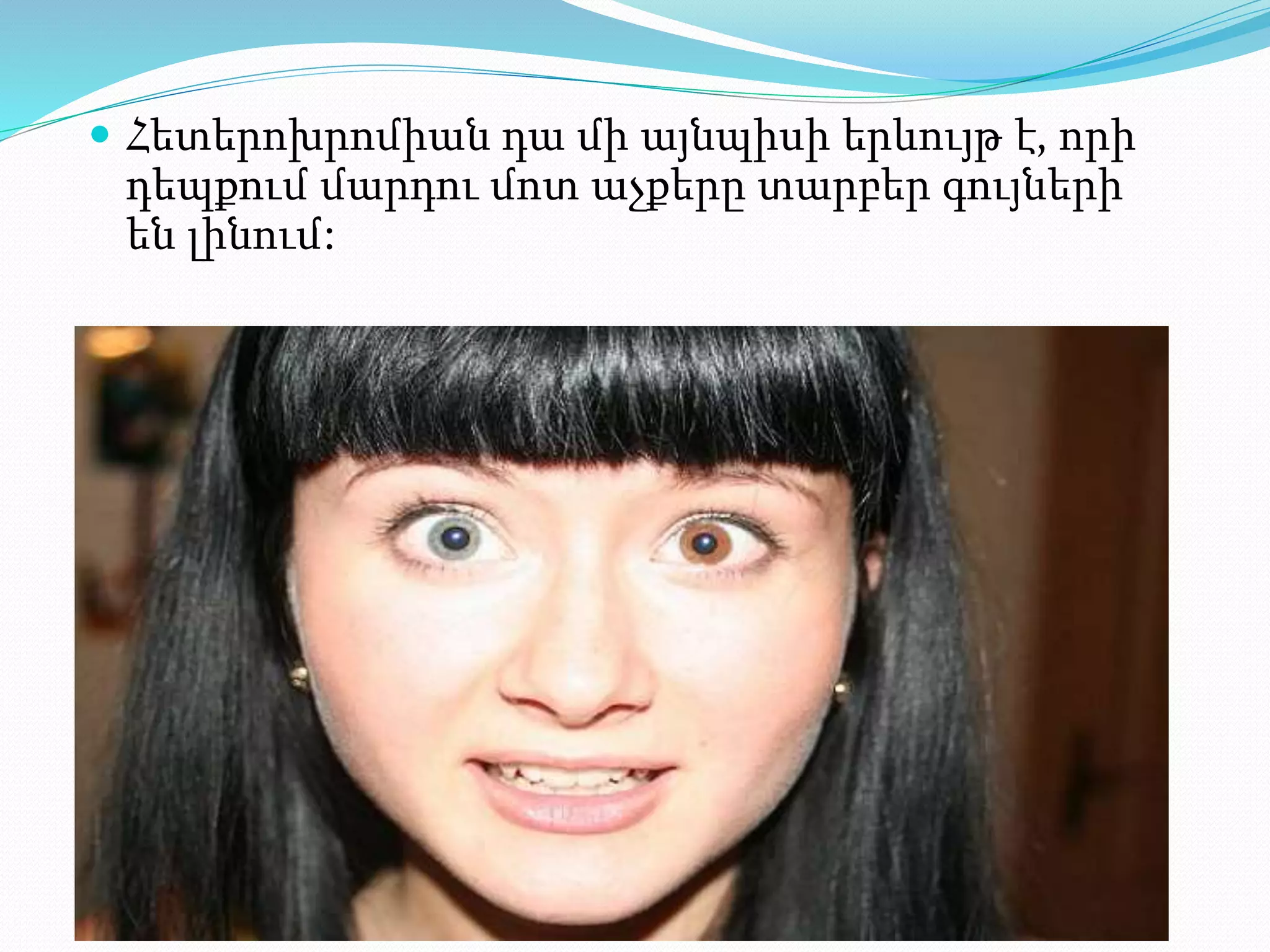  Հետերոխրոմիան դա մի այնպիսի երևույթ է, որի
դեպքում մարդու մոտ աչքերը տարբեր գույների
են լինում:
 