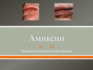 Способ применения