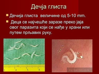 Дечја глистаДечја глиста
 Дечија глистаДечија глиста величине од 5-10 mm.величине од 5-10 mm.
 Деца се најчешће заразе преко јајаДеца се најчешће заразе преко јаја
овог паразита који се нађе у храни илиовог паразита који се нађе у храни или
путем прљавих руку.путем прљавих руку.
 