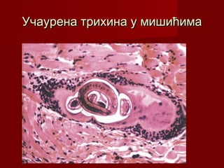 Учаурена трихина у мишићимаУчаурена трихина у мишићима
 