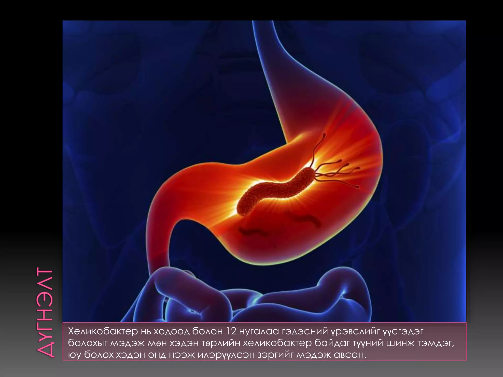 Хеликобактер нь ходоод болон 12 нугалаа гэдэсний үрэвслийг үүсгэдэг
болохыг мэдэж мөн хэдэн төрлийн хеликобактер байдаг түүний шинж тэмдэг,
юу болох хэдэн онд нээж илэрүүлсэн зэргийг мэдэж авсан.
 