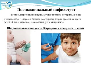 Поствакцинальный инфильтрат
Все инъекционные вакцины лучше вводить внутримышечно
У детей до 2 лет - передне-боковая поверхность бедра в средней ее трети.
Детей >2 лет и взрослые - в дельтовидную мышцу плеча. A
!
Шприц вводится под углом 90 градусов к поверхности кожи
 