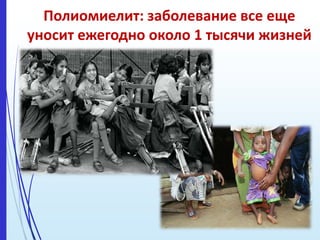 Полиомиелит: заболевание все еще
уносит ежегодно около 1 тысячи жизней
 