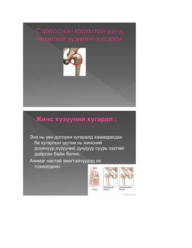 доод мөчдийн гэмтэл | PDF