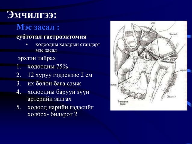 Ходоодны хорт хавдар