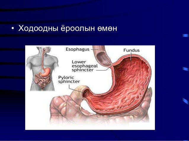 Ходоодны хорт хавдар