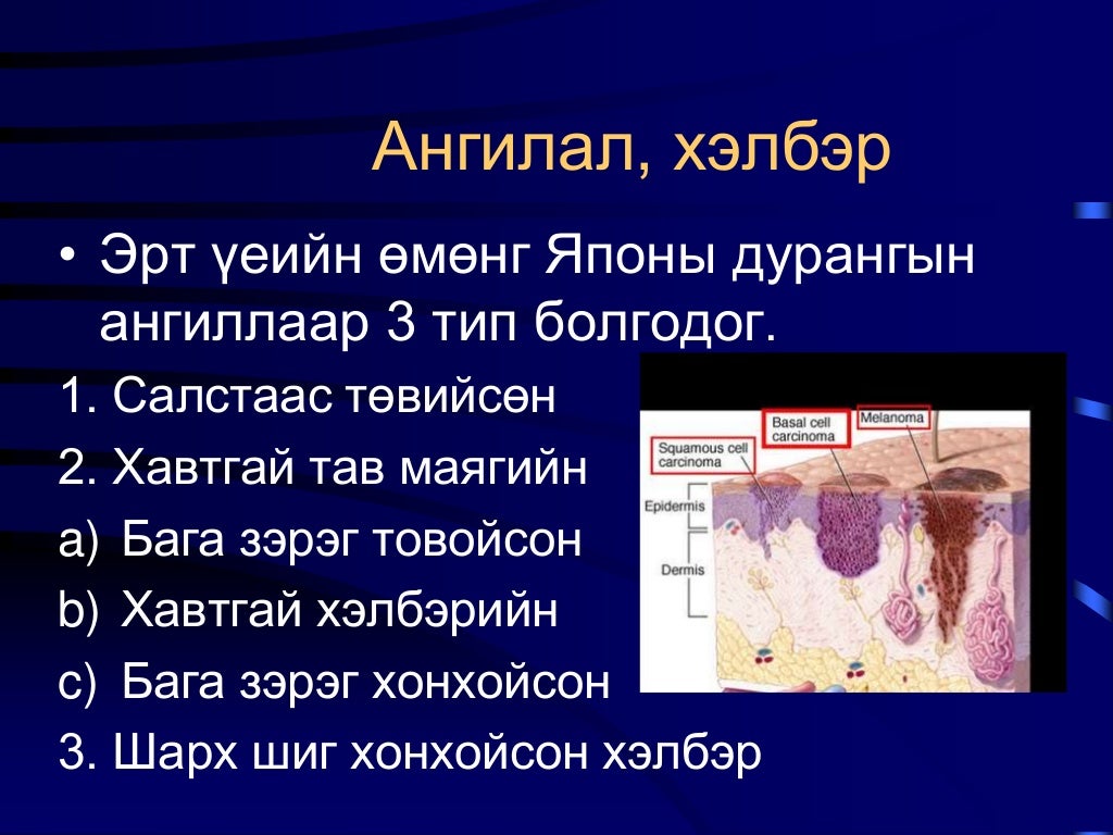 Ходоодны хорт хавдар