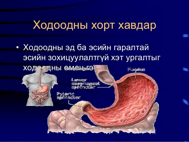 Ходоодны хорт хавдар