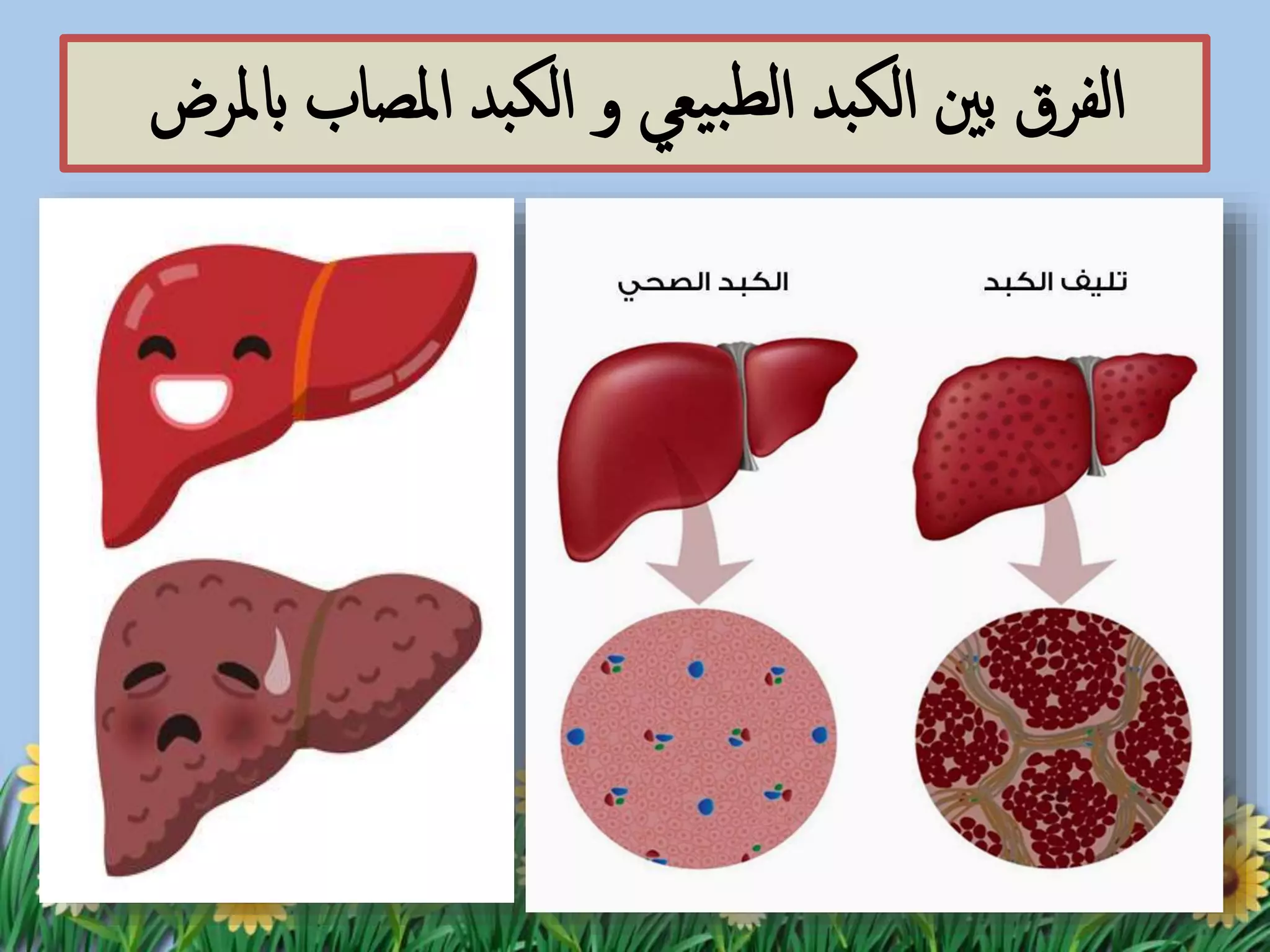 التهاب الكبد الوبائي | PPTX