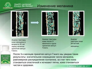 После 3-х месяцев принятия капсул Гинкго мы увидим такие
результаты: значительное сокращение числа меланина,
равномерное распределение коллагена, за счет чего кожа
становиться эластичной и исчезают пятна, кожа становиться
чистая и здоровая.
Изменение меланина
Анализ текстуры
кожи женщины в
возрасте 45 лет
перед началом
принятия капсул
Гинкго.
Анализ текстуры
кожи после 3-
месячного курса
принятия капсул
Гинкго.
Анализ
текстуры кожи
34-летней
женщины.
 