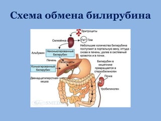 Лечение Неонатальной Желтухи | PPT