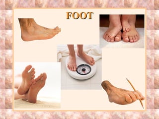 FOOTFOOT
 