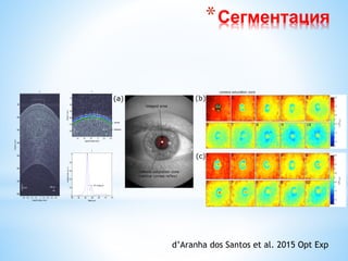*Сегментация
a
50 m 200 m
*
Depth(um)
Lateral Position (mm)
0.4 0.8 1.2 1.6 2 2.4 2.8 3.2 3.6
100
200
300
400
500
600
700
800
10 m
50 m
 Tear film
 Epithelium
b
Depth(um)
Lateral Position (mm)
1.4 1.6 1.8 2 2.2 2.4
70
80
90
100
110
120
85 90 95 100 105 110 115
0
0.2
0.4
0.6
0.8
1
Magnitude(a.u.)
c
TFT =3.095 m
Depth (m)
d’Aranha dos Santos et al. 2015 Opt Exp
 