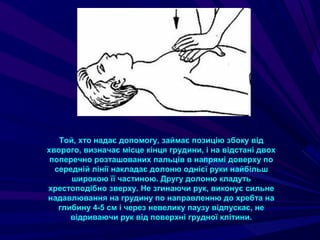 Той, хто надає допомогу, займає позицію збоку від
хворого, визначає місце кінця грудини, і на відстані двох
поперечно розташованих пальців в напрямі доверху по
середній лінії накладає долоню однієї руки найбільш
широкою її частиною. Другу долоню кладуть
хрестоподібно зверху. Не згинаючи рук, виконує сильне
надавлювання на грудину по направленню до хребта на
глибину 4-5 см і через невелику паузу відпускає, не
відриваючи рук від поверхні грудної клітини.
 