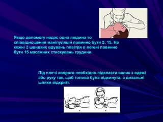 Якщо допомогу надає одна людина то
співвідношення маніпуляцій повинно бути 2: 15. На
кожні 2 швидких вдувань повітря в легені повинно
бути 15 масажних стискувань грудини.
Під плечі хворого необхідно підкласти валик з одежі
або руку так, щоб голова була відкинута, а дихальні
шляхи відкриті.
 