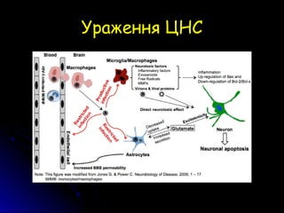 Ураження ЦНСУраження ЦНС
 