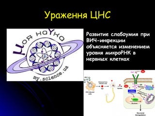 Ураження ЦНСУраження ЦНС
Развитие слабоумия при
ВИЧ-инфекции
объясняется изменением
уровня микроРНК в
нервных клетках
 