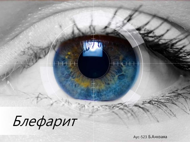 Блефарит