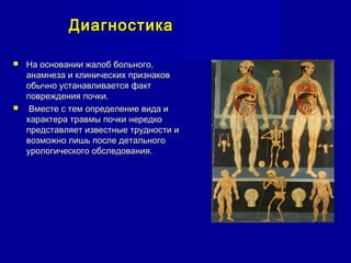 ДиагностикаДиагностика
 На основании жалоб больного,На основании жалоб больного,
анамнеза и клинических признакованамнеза и клинических признаков
обычно устанавливается фактобычно устанавливается факт
повреждения почки.повреждения почки.
 Вместе с тем определение вида иВместе с тем определение вида и
характера травмы почки нередкохарактера травмы почки нередко
представляет известные трудности ипредставляет известные трудности и
возможно лишь после детальноговозможно лишь после детального
урологического обследования.урологического обследования.
 