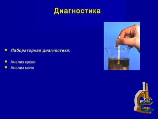 ДиагностикаДиагностика
 Лабораторная диагностика:Лабораторная диагностика:
 Анализ кровиАнализ крови
 Анализ мочиАнализ мочи
 