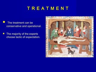 T R E A T M E N TT R E A T M E N T
 The treatment can beThe treatment can be
conservative and operational.conservative and operational.
 The majority of the expertsThe majority of the experts
choose tactic of expectation.choose tactic of expectation.
 