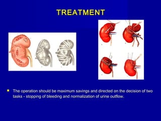 TREATMENTTREATMENT
 The operation should be maximum savings and directed on the decision of twoThe operation should be maximum savings and directed on the decision of two
tasks - stopping of bleeding and normalization of urine outflow.tasks - stopping of bleeding and normalization of urine outflow.
 