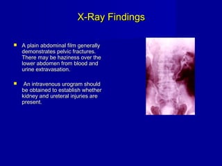 X-Ray FindingsX-Ray Findings
 A plain abdominal film generallyA plain abdominal film generally
demonstrates pelvic fractures.demonstrates pelvic fractures.
There may be haziness over theThere may be haziness over the
lower abdomen from blood andlower abdomen from blood and
urine extravasation.urine extravasation.
 An intravenous urogram shouldAn intravenous urogram should
be obtained to establish whetherbe obtained to establish whether
kidney and ureteral injuries arekidney and ureteral injuries are
present.present.
 