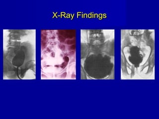 X-Ray FindingsX-Ray Findings
 