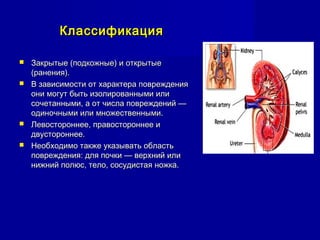КлассификацияКлассификация
 Закрытые (подкожные) и открытыеЗакрытые (подкожные) и открытые
(ранения).(ранения).
 В зависимости от характера поврежденияВ зависимости от характера повреждения
они могут быть изолированными илиони могут быть изолированными или
сочетанными, а от числа повреждений —сочетанными, а от числа повреждений —
одиночными или множественными.одиночными или множественными.
 Левостороннее, правостороннее иЛевостороннее, правостороннее и
двустороннее.двустороннее.
 Необходимо также указывать областьНеобходимо также указывать область
повреждения: для почки — верхний илиповреждения: для почки — верхний или
нижний полюс, тело, сосудистая ножка.нижний полюс, тело, сосудистая ножка.
 