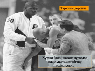 Хүүхэд болон насанд хүрэсдэд
ижил давтамжтайгаар
тохиолддог.
Тархины доргилт
 