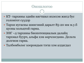 Оношлогоо
 КТ- тархины эдийн нягтшил ихэссэн жигд бус
голомтот сүүдэр
 Тархи нугасны шингэний даралт 85-20 мм м.у.б
цусны хольцтой гарна.
 ЭЭГ –д тархины биопотенциалын далайц
тархмал буурч, альфа хэм өөрчлөгдөнө. Дельта
долгион гарна.
 Талбөмбөлөг хоорондын тэгш хэм алдагдал
 