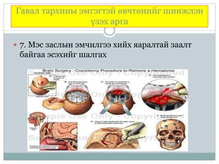 Гавал тархины эмгэгтэй өвчтөнийг шинжлэн
үзэх арга
 7. Мэс заслын эмчилгээ хийх яаралтай заалт
байгаа эсэхийг шалгах
 