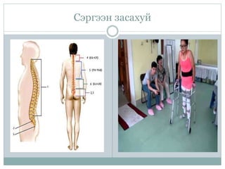 Сэргээн засахуй
 