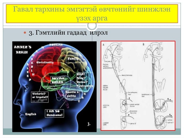 гавал тархины гэмтэл