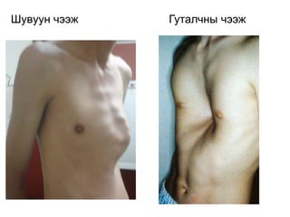 Шувуун чээж Гуталчны чээж
 